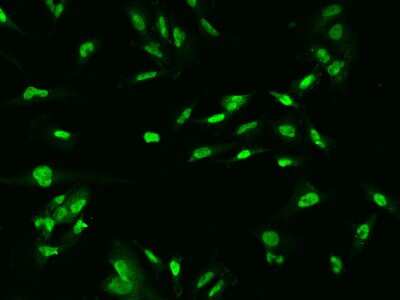 Immunocytochemistry/ Immunofluorescence: OGFOD1 Antibody [NBP2-97921]