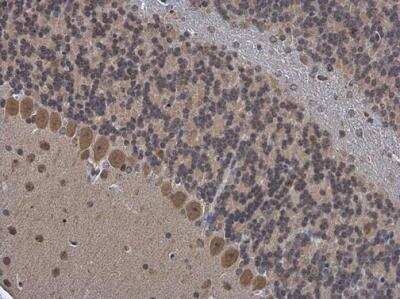 Immunohistochemistry-Paraffin: OGFOD1 Antibody [NBP2-19624]