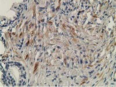 Immunohistochemistry: OGFOD1 Antibody (OTI1D9) - Azide and BSA Free [NBP2-73145]