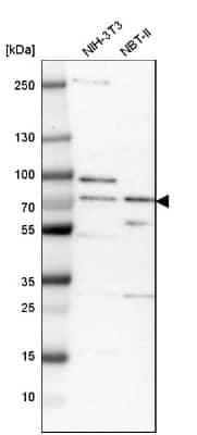 Western Blot: OGFOD1 Antibody [NBP1-83826]