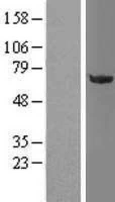 Western Blot: OGFOD1 Overexpression Lysate [NBL1-13914]