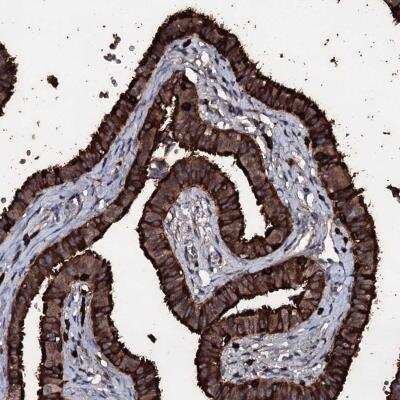 Immunohistochemistry: OGFOD2 Antibody [NBP1-82254]