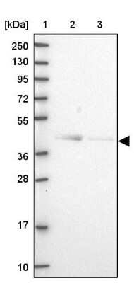 Western Blot: OGFOD2 Antibody [NBP1-82253]