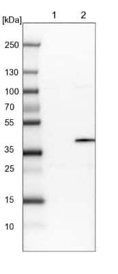 Western Blot: OGFOD2 Antibody [NBP1-82253]