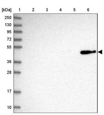 Western Blot: OGFOD2 Antibody [NBP1-82254]