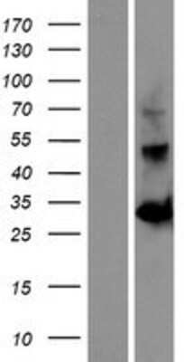 Western Blot: OGFOD2 Overexpression Lysate [NBP2-06311]