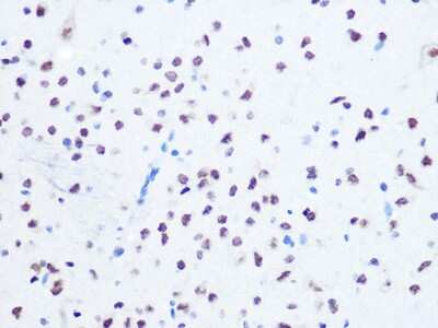 Immunohistochemistry-Paraffin: OGG1 Antibody (8V2Q9) [NBP3-16526]