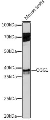 Western Blot: OGG1 Antibody (8V2Q9) [NBP3-16526]