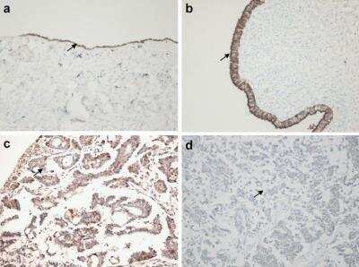 Immunohistochemistry: OGG1 Antibody - BSA Free [NB100-106]