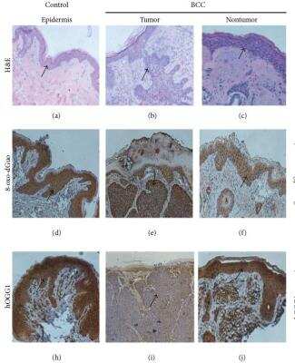 Immunohistochemistry: OGG1 Antibody - BSA Free [NB100-106]