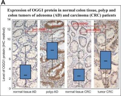 Immunohistochemistry-Paraffin: OGG1 Antibody - BSA Free [NB100-106]