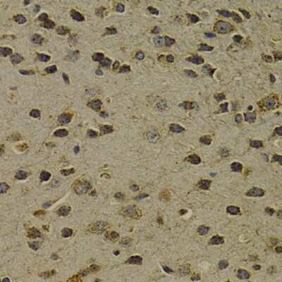 Immunohistochemistry-Paraffin: OGG1 Antibody - BSA Free [NBP2-95147]