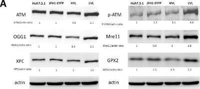 Western Blot: OGG1 AntibodyBSA Free [NB100-106]