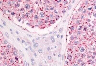 Immunohistochemistry-Paraffin: OGR1 Antibody - BSA Free [NBP1-02402]