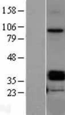 Western Blot: Mimecan/OIF Overexpression Lysate [NBL1-13917]