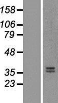 Western Blot: Mimecan/OIF Overexpression Lysate [NBL1-13918]