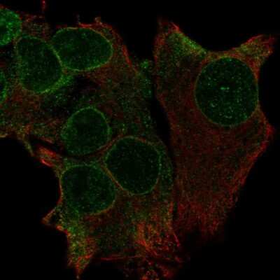 Immunocytochemistry/ Immunofluorescence: OIP106 Antibody [NBP2-55205]