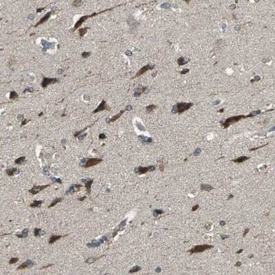 Immunohistochemistry-Paraffin: OIP106 Antibody [NBP1-87890]