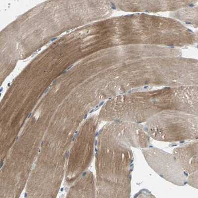 Immunohistochemistry-Paraffin: OIP106 Antibody [NBP1-87890]