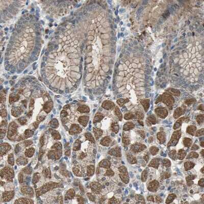 Immunohistochemistry-Paraffin: OIP106 Antibody [NBP1-87890]
