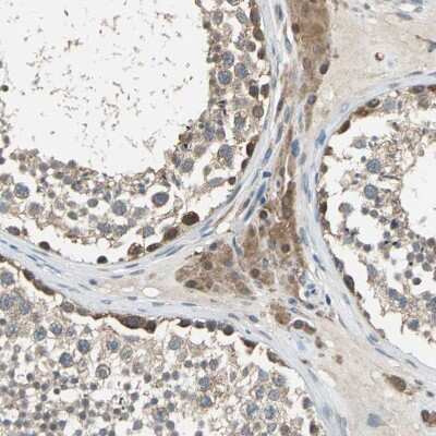 Immunohistochemistry-Paraffin: OIP106 Antibody [NBP1-87890]