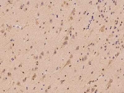 Immunohistochemistry-Paraffin: OIP106 Antibody [NBP2-98550]