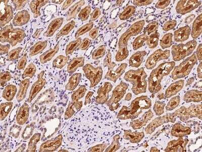 Immunohistochemistry-Paraffin: OIP106 Antibody [NBP2-98550]