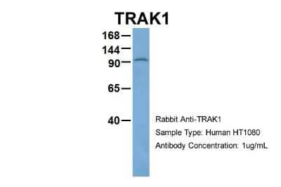 Western Blot: OIP106 Antibody [NBP1-56761]