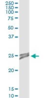 Immunoprecipitation: OIP5 Antibody (3G10-1D5) [H00011339-M01]