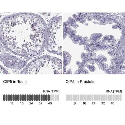 Immunohistochemistry-Paraffin: OIP5 Antibody [NBP2-13688]