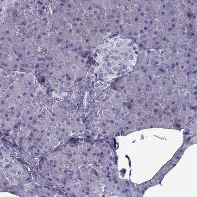 Immunohistochemistry-Paraffin: OIP5 Antibody [NBP2-13688]