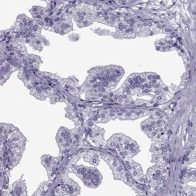 Immunohistochemistry-Paraffin: OIP5 Antibody [NBP2-13688]