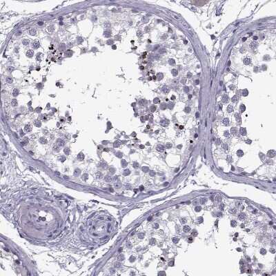 Immunohistochemistry-Paraffin: OIP5 Antibody [NBP2-13688]
