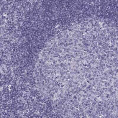 Immunohistochemistry-Paraffin: OIP5 Antibody [NBP2-13688]