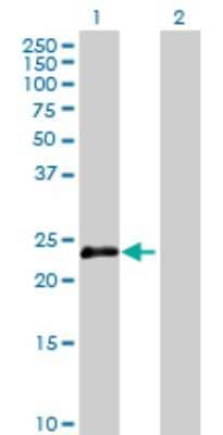 Western Blot: OIP5 Antibody [H00011339-B01P]