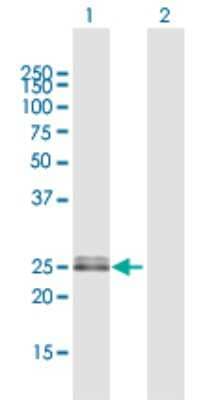 Western Blot: OIP5 Antibody [H00011339-D01P]