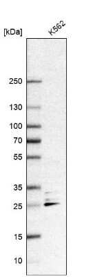 Western Blot: OIP5 Antibody [NBP2-13688]