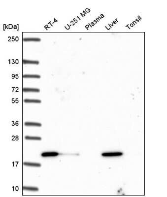 Western Blot: OIP5 Antibody [NBP2-56649]