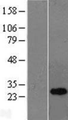 Western Blot: OIP5 Overexpression Lysate [NBL1-13920]