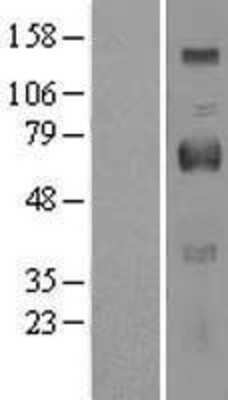 Western Blot: OIT3 Overexpression Lysate [NBL1-13921]