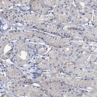 Immunohistochemistry-Paraffin: OLAH Antibody [NBP1-83780]