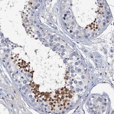 Immunohistochemistry-Paraffin: OLAH Antibody [NBP1-83780]