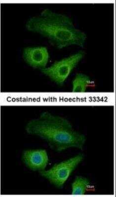 Immunocytochemistry/ Immunofluorescence: OLFM-L3 Antibody [NBP2-15055]