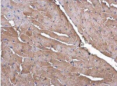 Immunohistochemistry-Paraffin: OLFM-L3 Antibody [NBP2-15055]