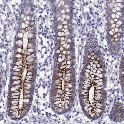 Immunohistochemistry-Paraffin: OLFM4 Antibody [NBP2-62720]