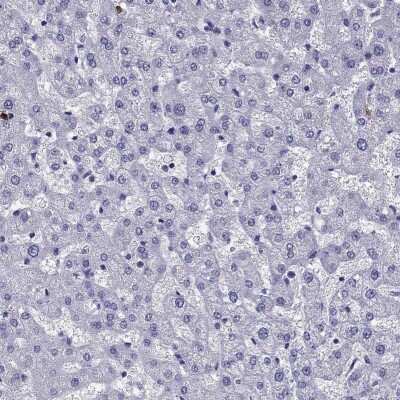 Immunohistochemistry-Paraffin: OLFM4 Antibody [NBP2-62720]