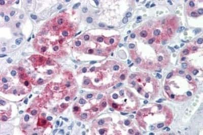 Immunohistochemistry-Paraffin: OLFM4 Antibody [NBP3-14432]