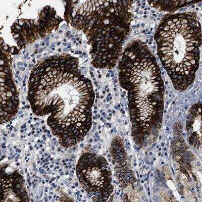 Immunohistochemistry-Paraffin: OLFML2A Antibody [NBP1-84655]