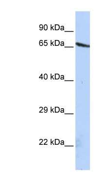 Western Blot: OLFML2A Antibody [NBP1-56749]