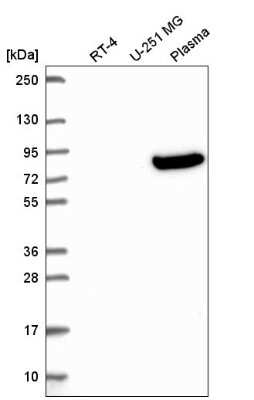 Western Blot: OLFML2B Antibody [NBP2-56685]